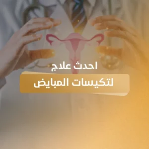 احدث علاج لتكيسات المبايض