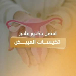 افضل دكتور علاج تكيسات المبيض