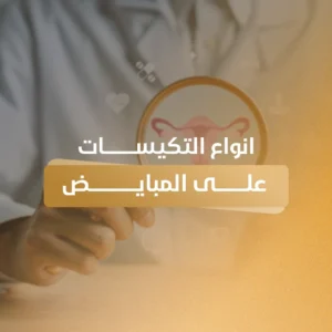 انواع التكيسات على المبايض