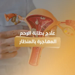 علاج بطانة الرحم المهاجرة بالمنظار الجراحي