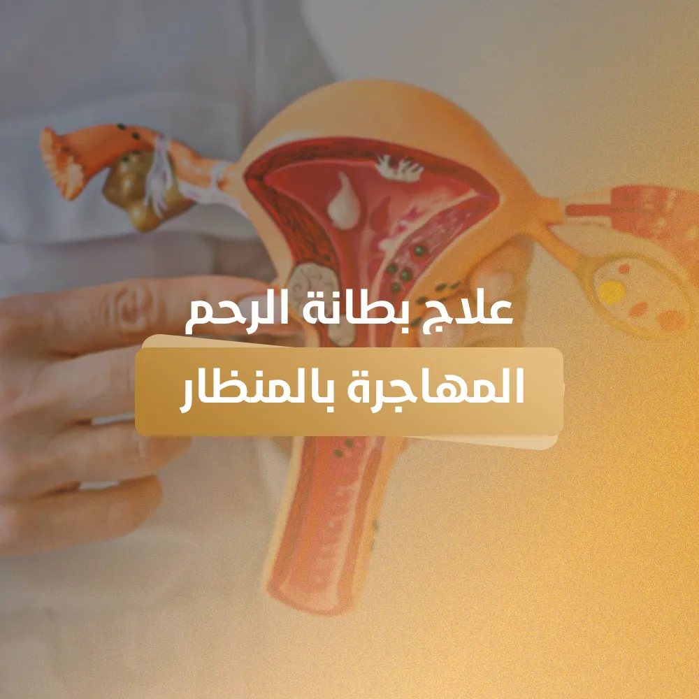 علاج بطانة الرحم المهاجرة بالمنظار الجراحي