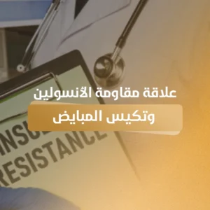 علاقة مقاومة الأنسولين وتكيس المبايض
