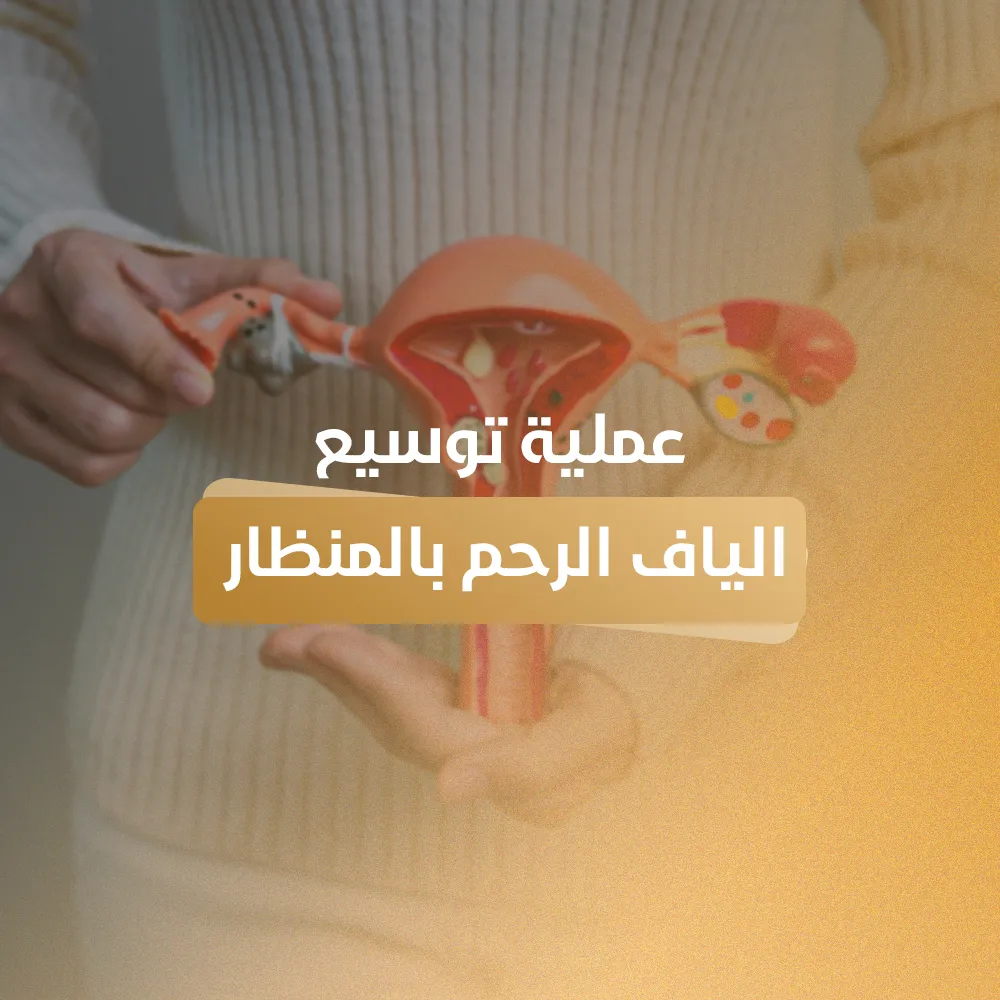 عملية توسيع الياف الرحم بالمنظار