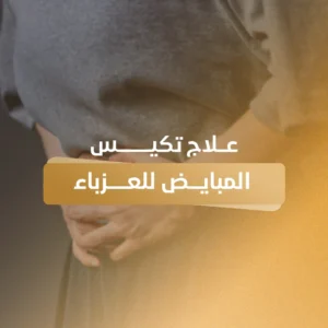 علاج تكيس المبايض للعزباء مع د. سامر ياغي