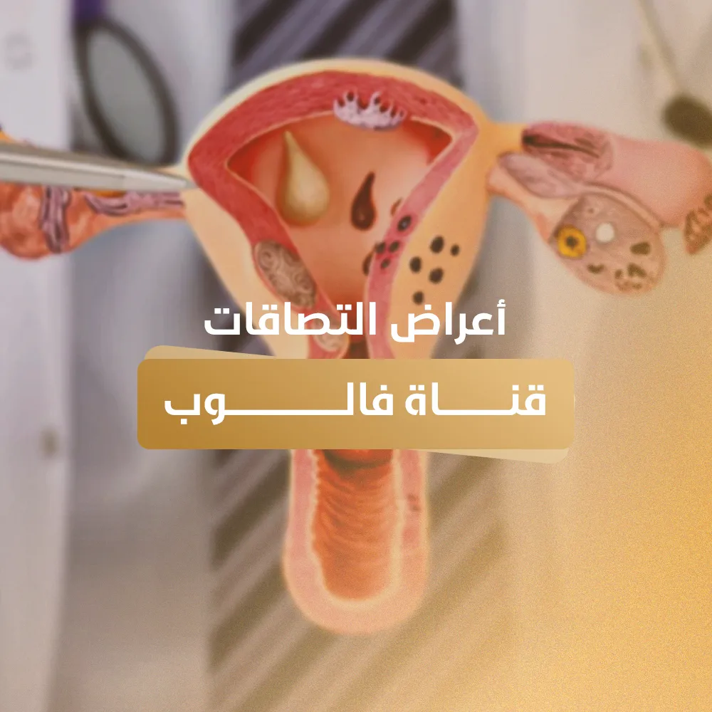 أعراض التصاقات قناة فالوب