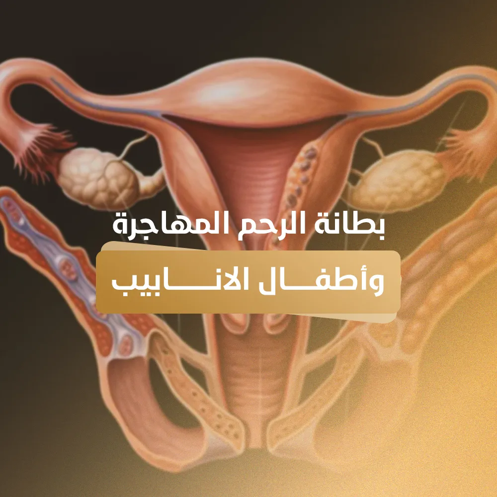 بطانة الرحم المهاجرة واطفال الانابيب