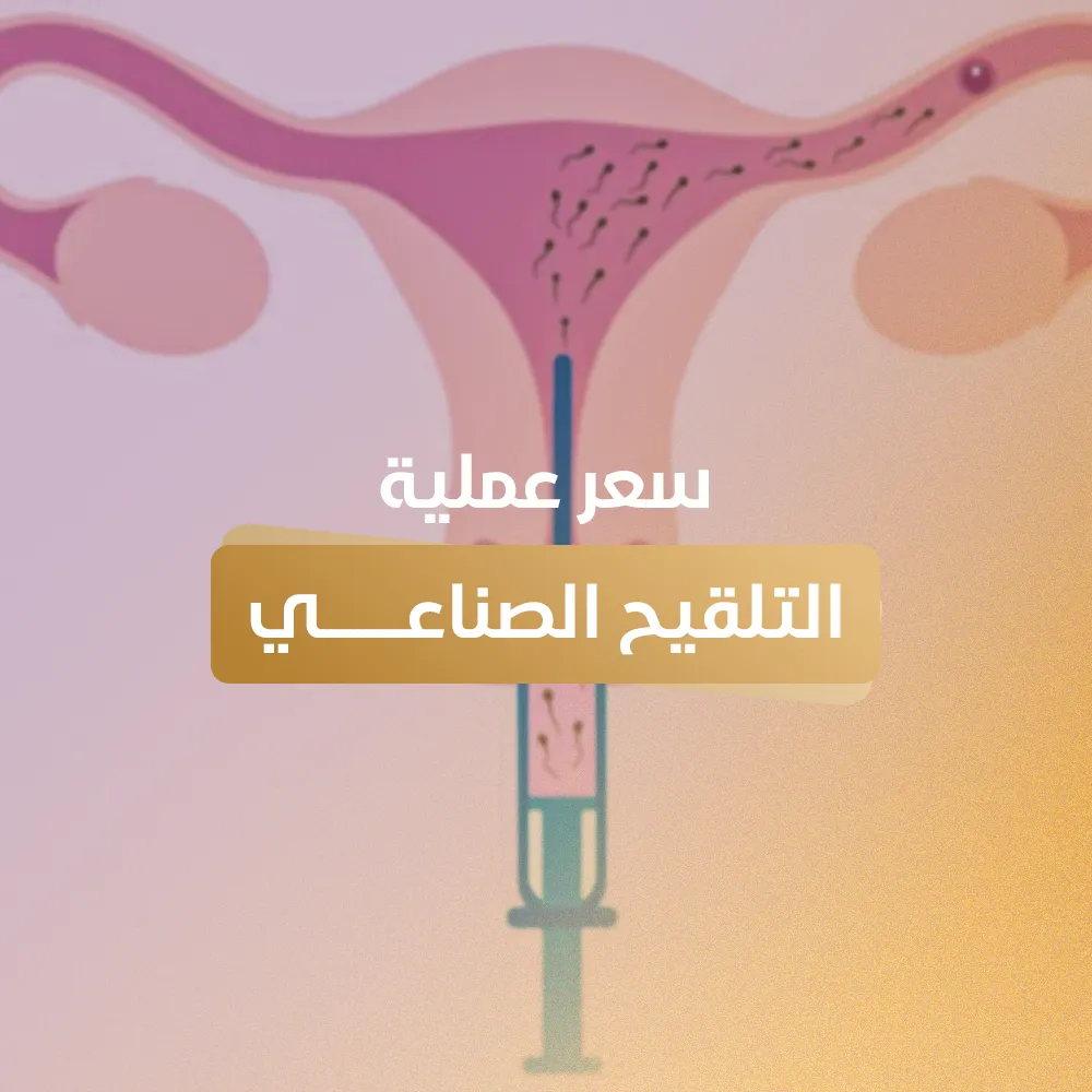 سعر عملية التلقيح الصناعي