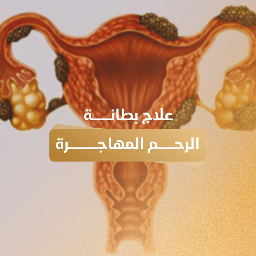 علاج بطانة الرحم المهاجرة
