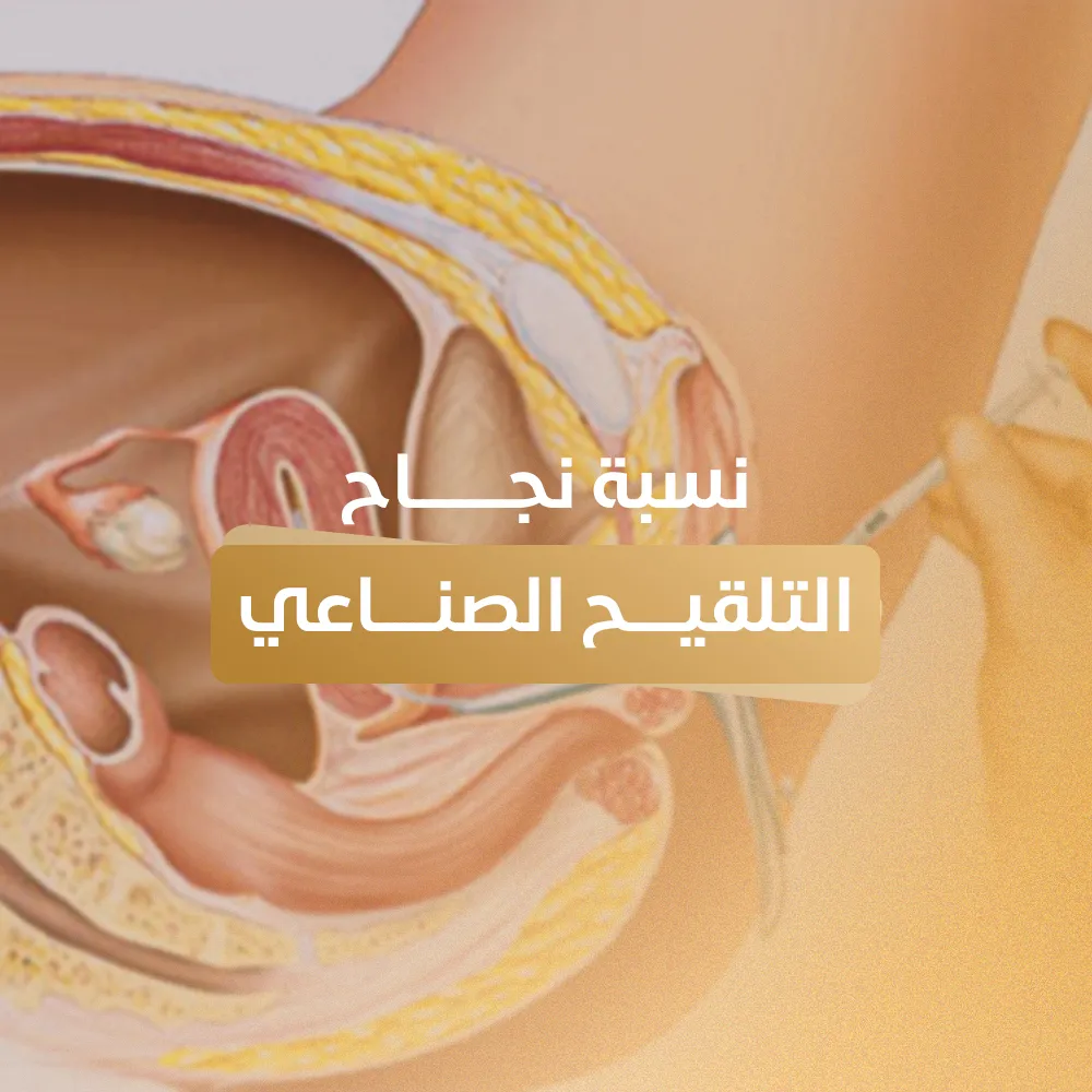 نسبة نجاح التلقيح الصناعي